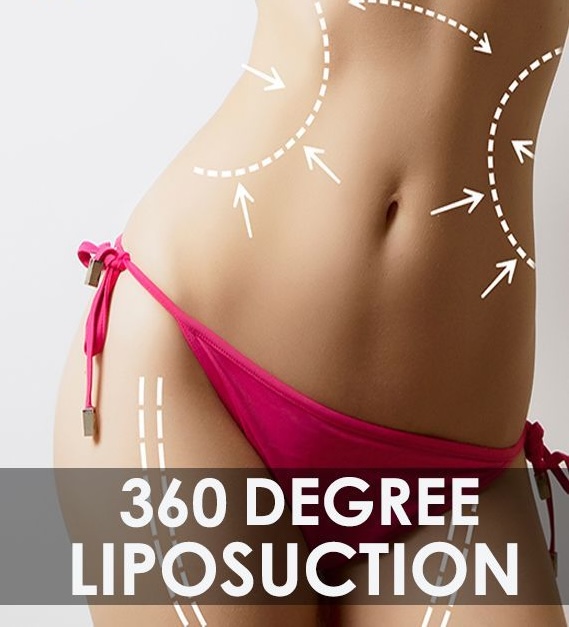 LIPOSUCTION